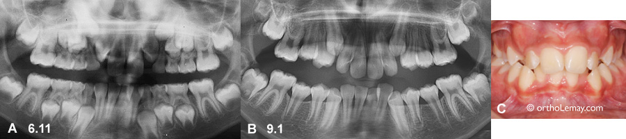 Fast dental development orthodontics 536674 CG9.1