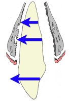Les dents se déplacent dans la direction de la force appliquée