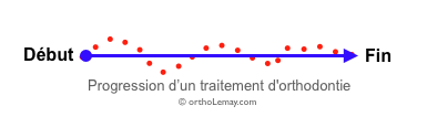 Progression d'un traitement d'orthodontie ligne droite