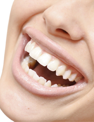 Les dents de sagesse ou troisièmes molaires ne causent pas de chevauchement dentaire et il n'est pas justifié de les extraire pour cette raison.