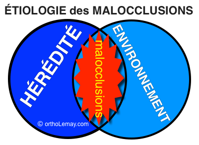 L'étiologie ou la cause des malocclusions dentaire est multiple. Les causes principales sont l'hérédité et l'environnement