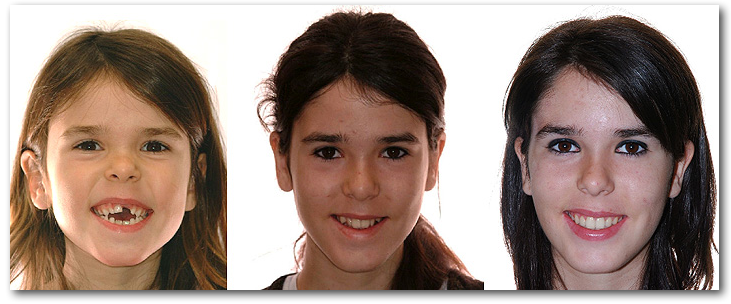Sourire  orthodontie AD 023263 S www.ortholemay.com Sherbrooke