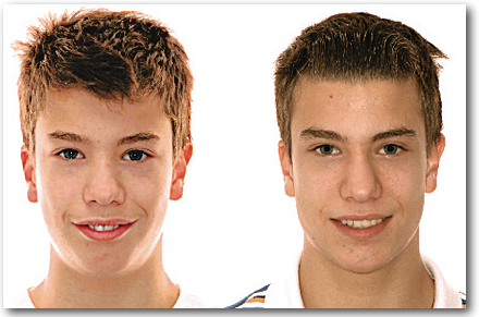 Sourire FB 053308 S Orthodontistes Lemay Sherbrooke