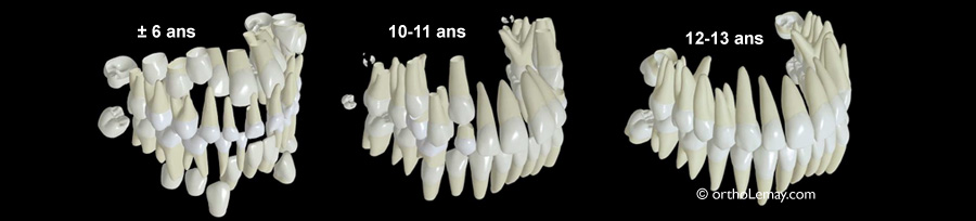 Diagramme montrant les étapes d'éruption dentaire entre 6 et 13 ans. 