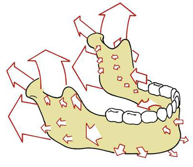 La croissance mandibulaire est un phénomène complexe qui se produit en 3 dimensions jusqu'à la fin de l'adolescence. 