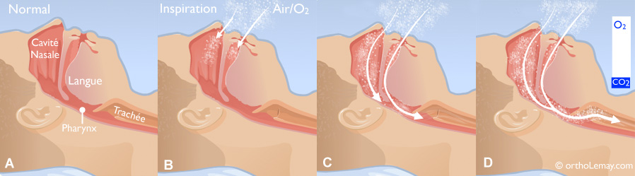 Apnee 1 du sommeil ronflement sleep apnea normal O2 ortholemay La respiration normale pendant le sommeil assure une bonne oxygénation.