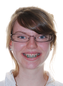 Gagnant du concours d'hygiène - Orthodontistes Lemay
