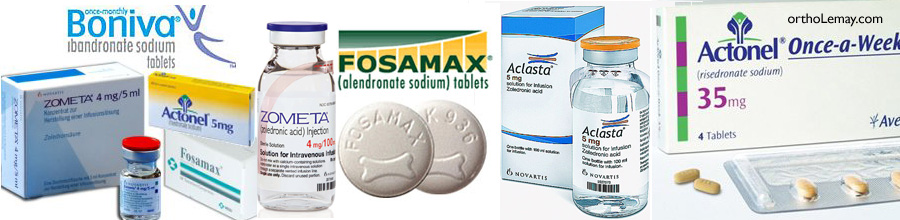 Différentes marques de bisphosphonates oraux et intraveineux disponibles sur le marché.