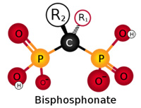 Bisphosphonates et orthodontie 