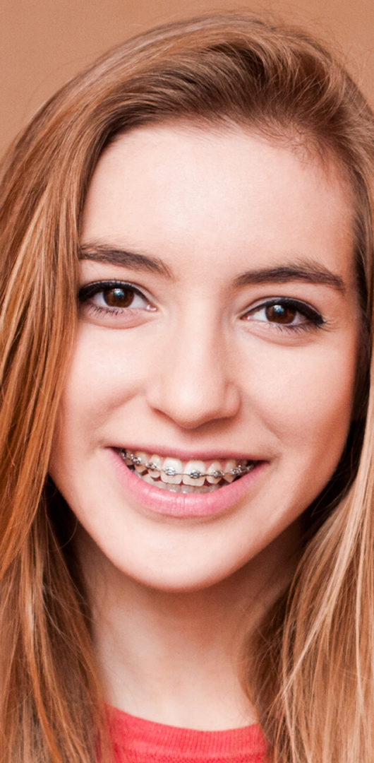 orthodontie enfants et adolescents